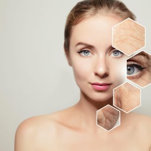 Anti-Wrinkle Treatments in Bangalore