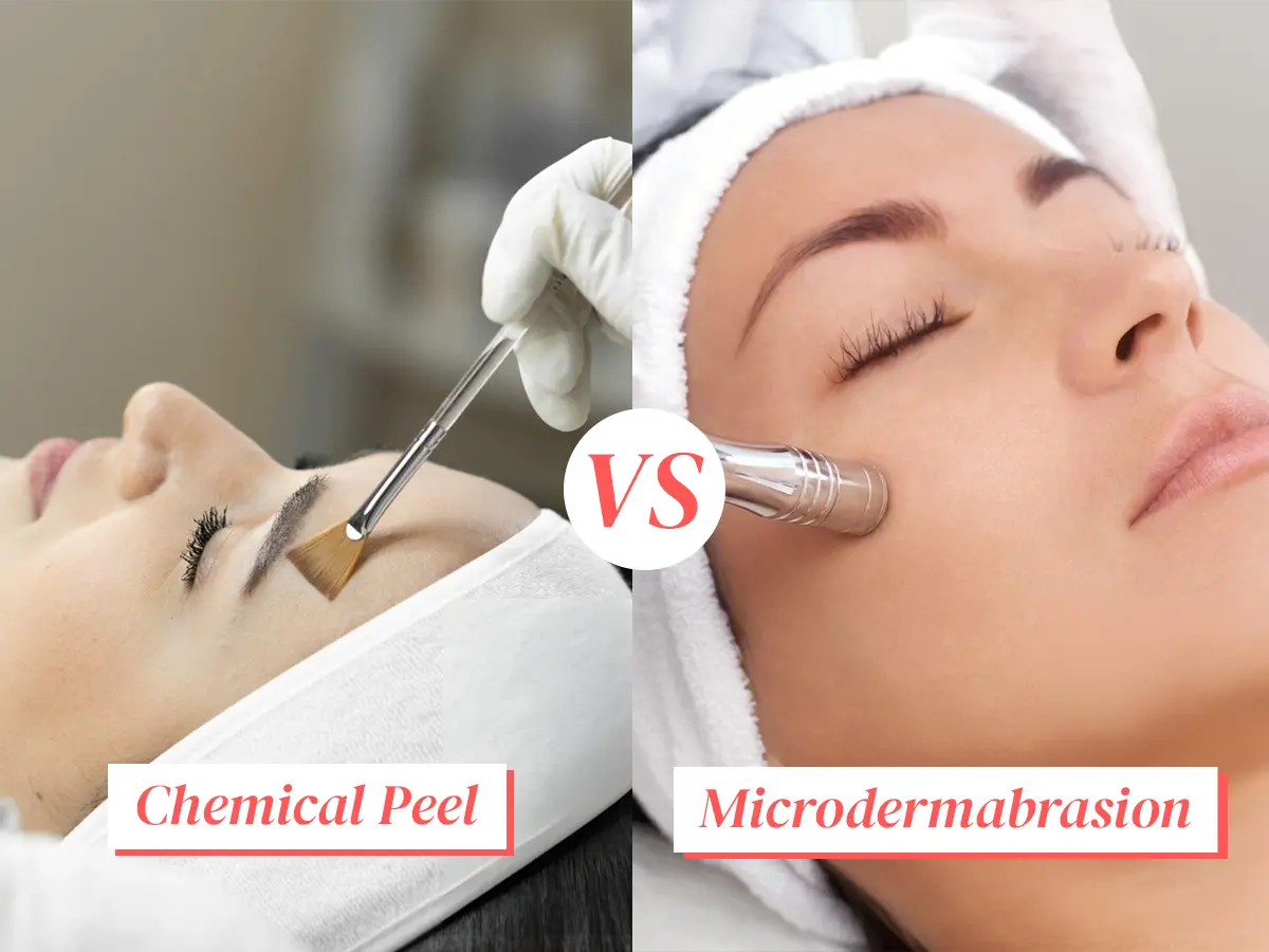 Chemical Peel vs. Microdermabrasion