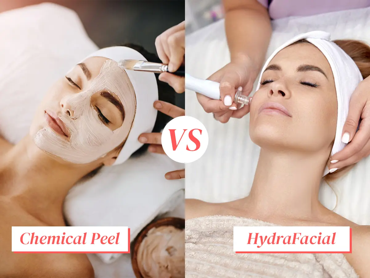 Hydro Peel vs Chemical Peel