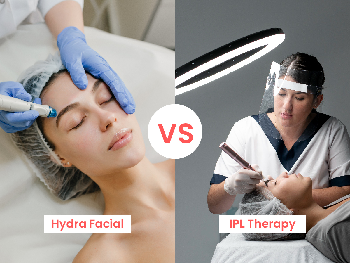 Hydra Facial vs IPL Therapy