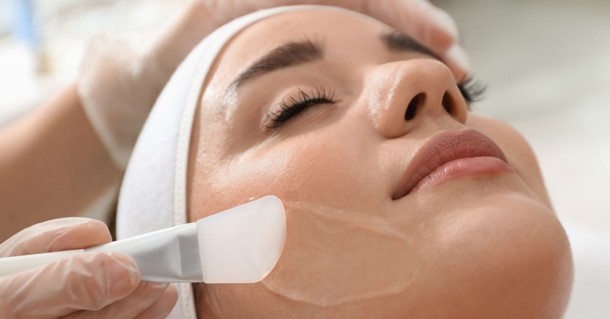 Chemical Peels for Melasma Treatment